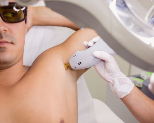 Impact Of Laser Hair Removal Treatment In Men